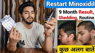 Restart Minoxidil 9 Month Result Shedding Routine  Kuch Nayi Baatein [upl. by Dehnel]