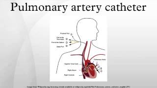 Pulmonary artery catheter [upl. by Pedaiah]