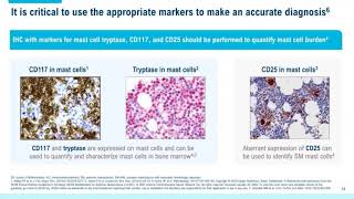 Systemic Mastocytosis Overview of Disease and Diagnosis for Pathologists [upl. by Jyoti]