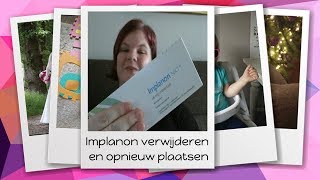 Implanon verwijderen en opnieuw laten plaatsen  vlog  66  de Maffe Mama [upl. by Hardej736]