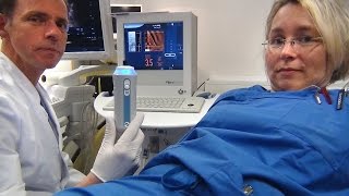 Fibroscan Leber ohne Punktierung per Ultraschall untersuchen [upl. by Mctyre758]