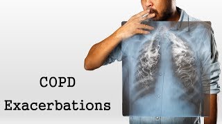 COPD Exacerbations [upl. by Hawker886]