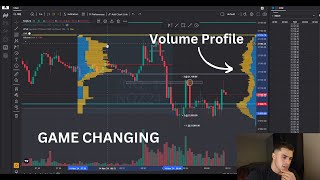 How Volume Profile can make you a profitable trader [upl. by Haisej]