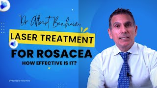 Laser Treatment For Rosacea How Effective Is It [upl. by Eldorado]