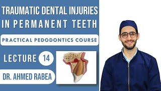 Lecture 14  Management of Traumatic Dental Injuries in PERMANENT Teeth  كورس بيدو عملي [upl. by Ainolopa]