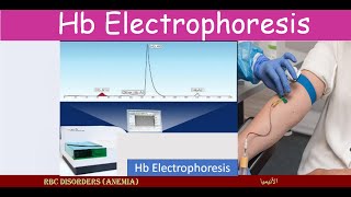 Lecture 231 Hemoglobin Electrophoresis [upl. by Georgianna736]