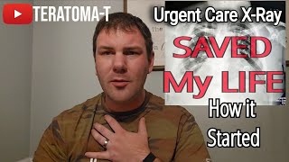 Huge tumor on my heart Mediastinal Teratoma The beginning of my story [upl. by Tedmund]