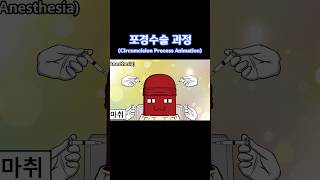 포경수술 과정The Circumcision Process Animation animation 병맛애니 [upl. by Chavez344]