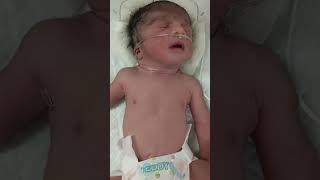 Term baby with RDS in NICU admissionmedicalstudent newborn nicu baby [upl. by Godewyn]