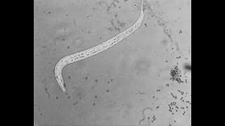 Nemátodo vs Trichoderma spp [upl. by Nowed]