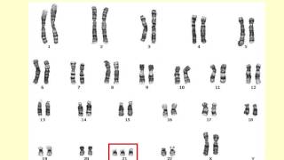 AS level E1 Chromosomes and the cell cycle Ms Cooper [upl. by Blaseio]