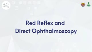 Red Reflex and Direct Ophthalmoscope [upl. by Ylremik]