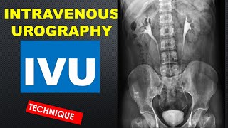 IVU  Intravenous urography technique tutorial for radiographers [upl. by Stanzel]