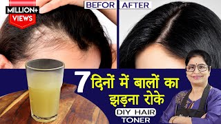 बालों का झड़ना जड़ से खत्म करें कितने भी खराब क्यों न हो नए बाल उगाये  Homemade Hair Growth Toner [upl. by Zertnom616]