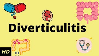 Diverticulitis Causes SIgns and Symptoms Diagnosis and Treatment [upl. by Aisul]