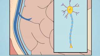 Understanding Diffuse Axonal Injury [upl. by Keffer]