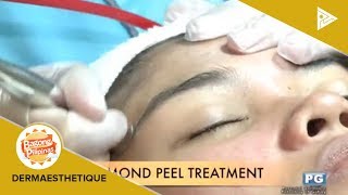 DERMAESTHETIQUE Diamond peel treatment [upl. by Eissoj425]