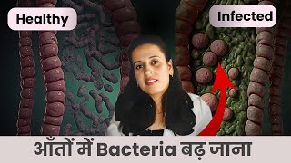 Detox you intestine  SMALL INTESTINAL BACTERIA OVERGROWTH  SIBO in hindi  Dr Neha Joshi [upl. by Isiah16]