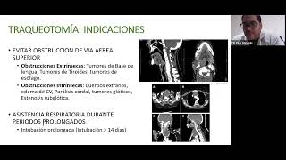 TELECAPACITACION TRAQUEOTOMÍA DR JOSE NOVOA PEREZ JEFE DEL SERVICIO DE CIRUGÍA DE CABEZA CUELLO Y [upl. by Tower]