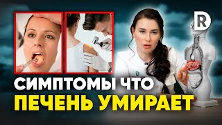 5 симптомов ЗАБОЛЕВАНИЯ ПЕЧЕНИ Чем ОПАСНЫ проблемы с ПЕЧЕНЬЮ [upl. by Jorey]