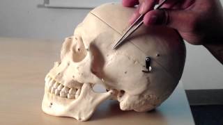 Skull Anatomy 1 of 5 Superior Posterior and Lateral Views  Head and Neck Anatomy 101 [upl. by Ramah]