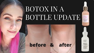 Update Botox In A Bottle  The Ordinary 10 Argireline amp Pink skincare 10 Argireline 10 Matrixyl [upl. by Lambrecht]