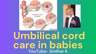 Tips to look after the babys umbilical cord area cordcare umbilicalcordcare [upl. by Wilkie]