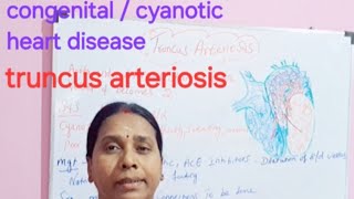 congenital cyanotic heart disease truncus arteriosis class in tamil [upl. by Preuss]