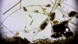 🔬 Rädertierchen Rotifer  Leben im Wassertropfen  microorganisms under microscope life in a drop [upl. by Darci]