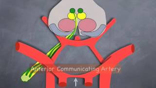 3rd Nerve Palsy [upl. by Liahus]