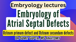 Atrial Septal Defects  Embryological basis [upl. by Diarmuid]