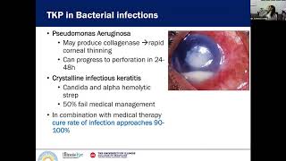 Penetrating Keratoplasty in Infectious Keratitis [upl. by Ecyaj]