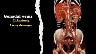 gonadal vien anatomy [upl. by Beesley]