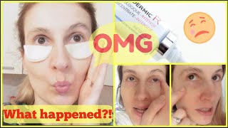 ALLERGIC REACTION TO RETINOL MUST WATCH BEFORE USING LA ROCHE POSAY REDERMIC R INTENSIVE EYE CREAM [upl. by Matt]