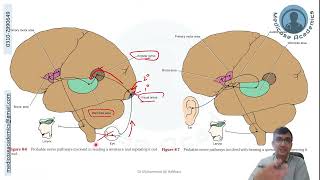 Speech amp Aphasia [upl. by Joao]