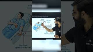 Function of Artificial Kidney  Hemodialysis  Class 10 Biology shorts reels biology [upl. by Ofloda]