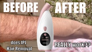 IPL Hair Removal My 8 Week Experiment amp Results [upl. by Solegnave]