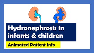 Hydronephrosis Explained Animated Patient Info [upl. by Elyrpa]