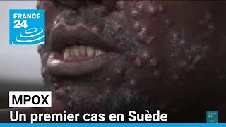 Mpox  un premier signalement en Suède lOMS alerte sur le risque dautres cas importés en Europe [upl. by Boyce]