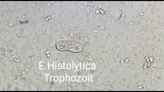 Trophozoite of Entamoeba histolytica [upl. by Leoline242]