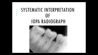 Systematic interpretation of IOPA radiograph [upl. by Jeremias285]