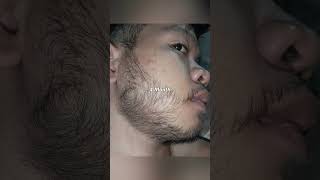 Kirkland Minoxidil Beard Journey 4 MONTH TRANSFORMATION [upl. by Anoed]