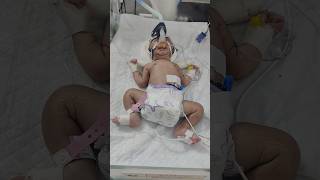 CPAP MACHINE SUPPORT ADMITTED IN NICU [upl. by Dopp91]