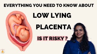 What is low lying placenta   Can Low Lying Placenta be dangerous to baby  Placenta previa [upl. by Hasila772]