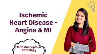 Ischemic Heart Disease  Angina amp Myocardial Infarction  MCQ concepts [upl. by Rosenblum514]