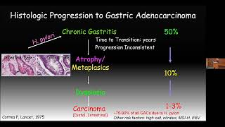 Yale Cancer Center Grand Rounds  May 10 2024 [upl. by Ynoble]