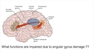 PROSOPAGNOSIA Face blindnessANGULAR GYRUS LESIONS [upl. by Xed830]