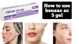 Benzac Ac benzole peroxide 50 mg active acne treatmentshrink open poresclean dark spot [upl. by Romilly825]