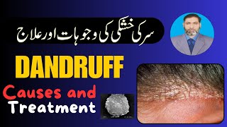 What is Dandruff Khushki its Causes and management [upl. by Pail]