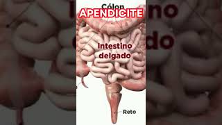 APENDICITE CAUSAS SINTOMAS TRATAMENTO [upl. by Cavil878]